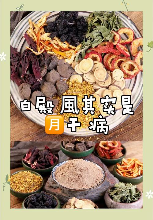 白斑治疗15种偏方:女儿白斑靠饮食自愈了